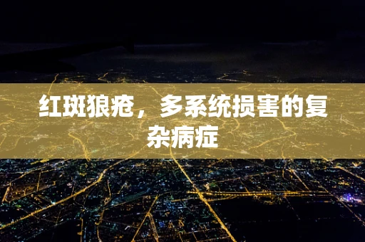 红斑狼疮，多系统损害的复杂病症